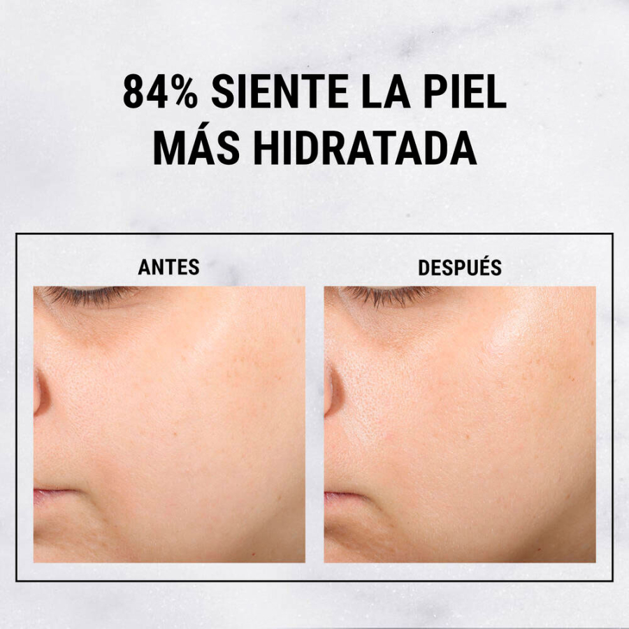 ultra-pure-high-potency-hyaluronic-acid-serum ultra-pure-high-potency-hyaluronic-acid-serum