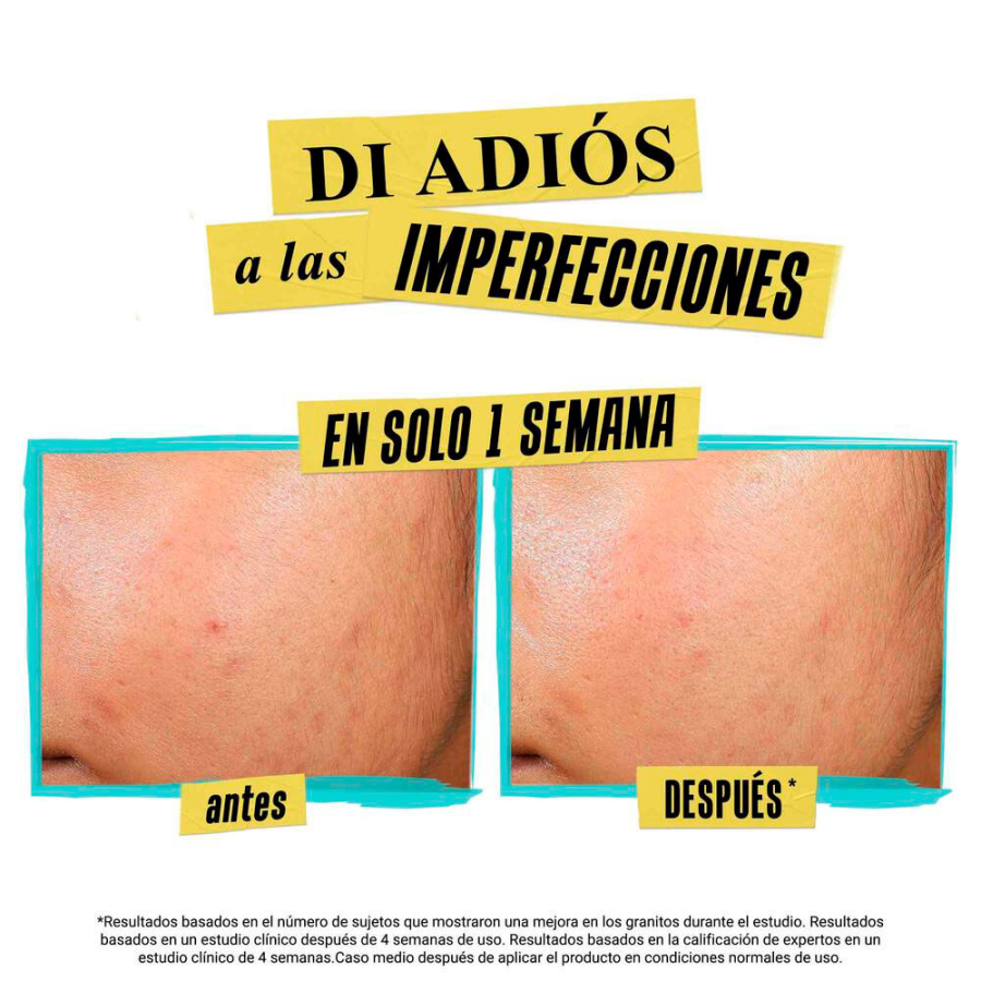 expertly-clear-blemish-treating-preventing-lotion expertly-clear-blemish-treating-preventing-lotion