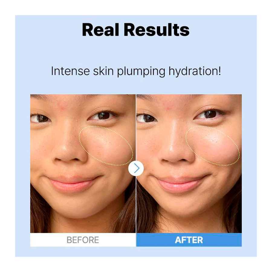 the-hyaluronic-acid-3-serum-feuchtigkeitsspendende-gesichtscreme