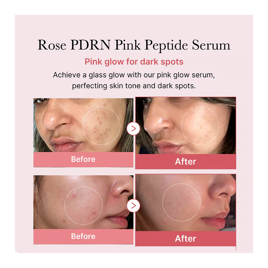 pdrn-pink-peptide-serum-hydraterend-en-verstevigend-serum