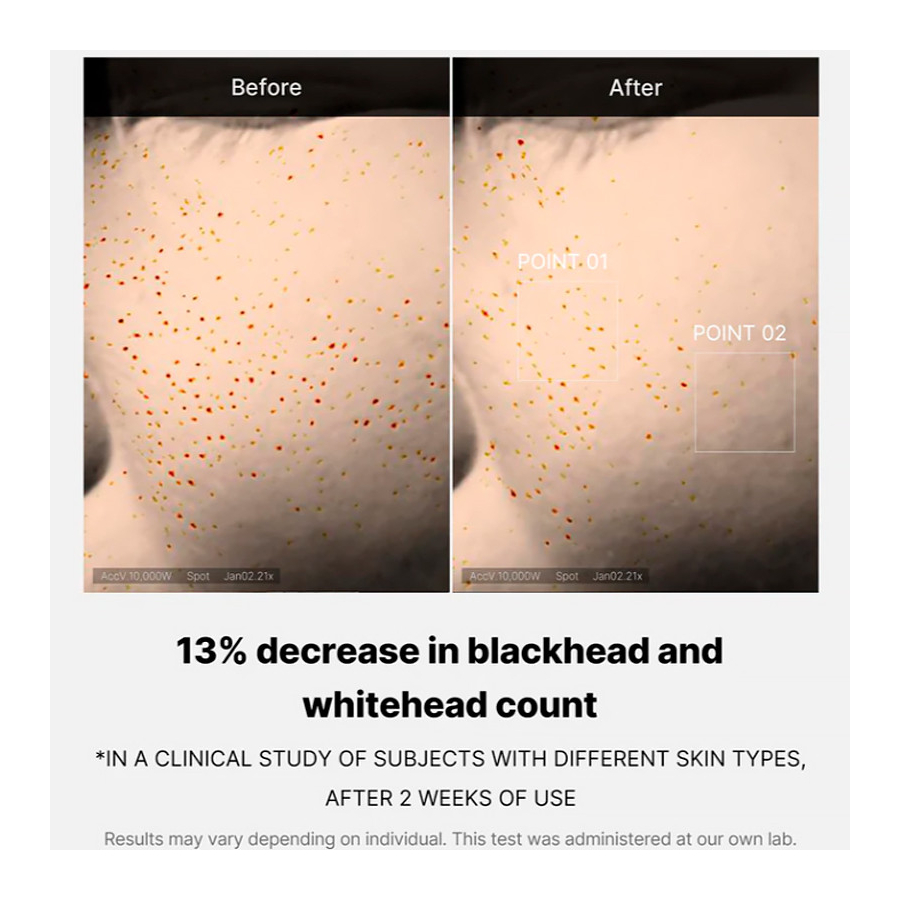 zero-pore-one-day-serum-peelingujace-serum-do-twarzy-srodek-oczyszczajacy zero-pore-one-day-serum-peelingujace-serum-do-twarzy-srodek-oczyszczajacy
