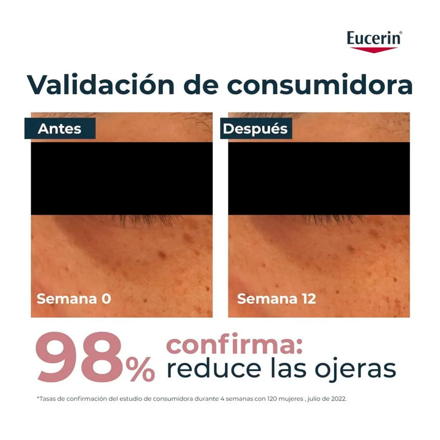 anti-pigment-eye-contour