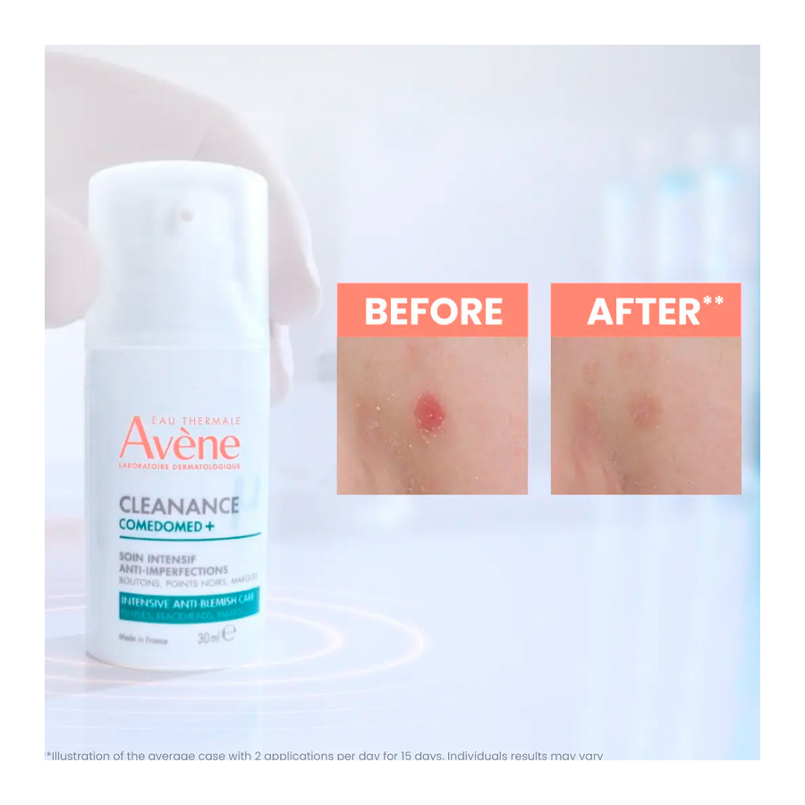 cleanance-comedomed-cuidado-intensivo-anti-imperfecciones