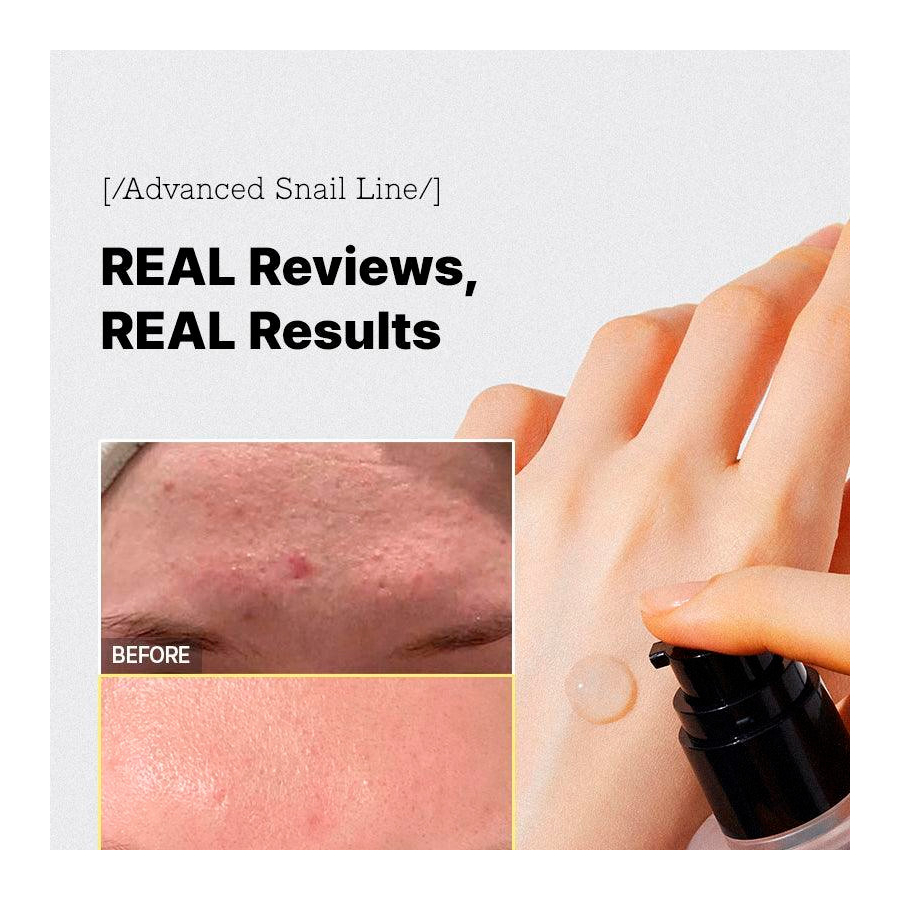 advanced-snail-96-mucin-power-essence-regenerative-treatment-anti-wrinkle advanced-snail-96-mucin-power-essence-regenerative-treatment-anti-wrinkle