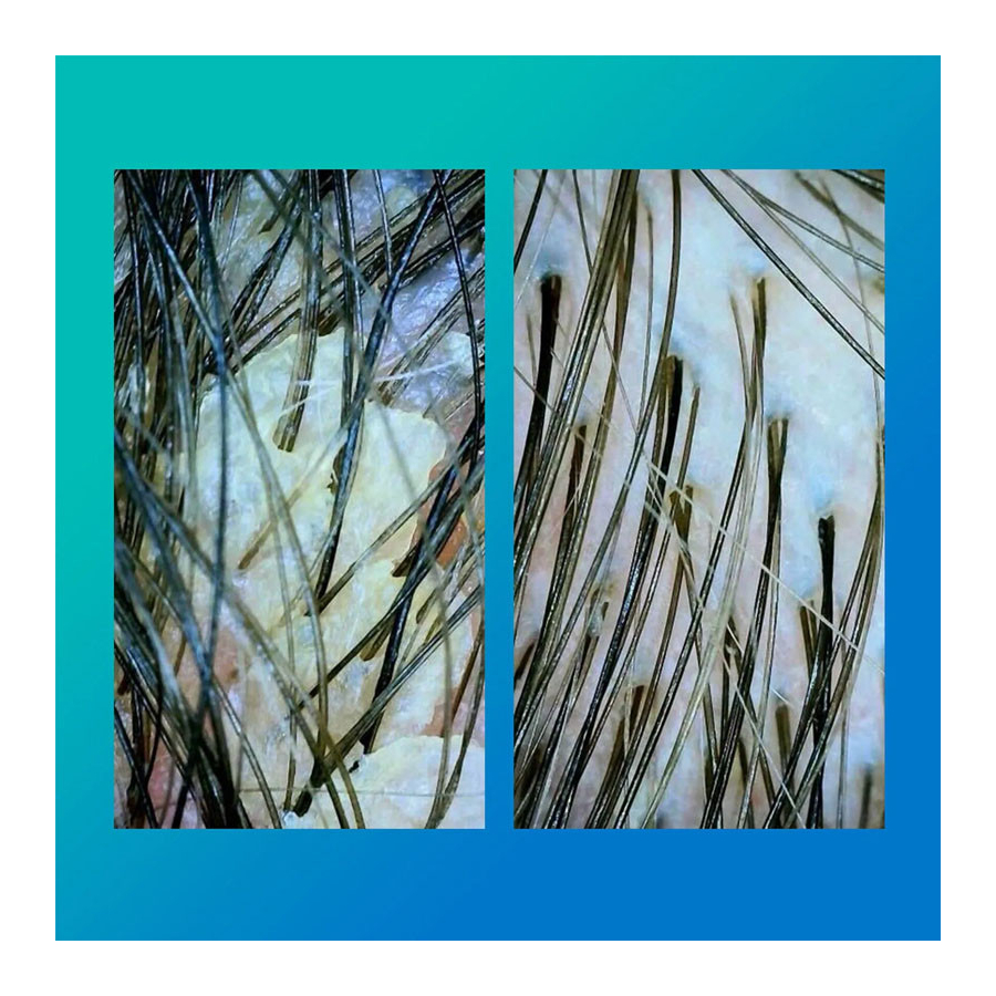 peptide-prep-detox-shampoo