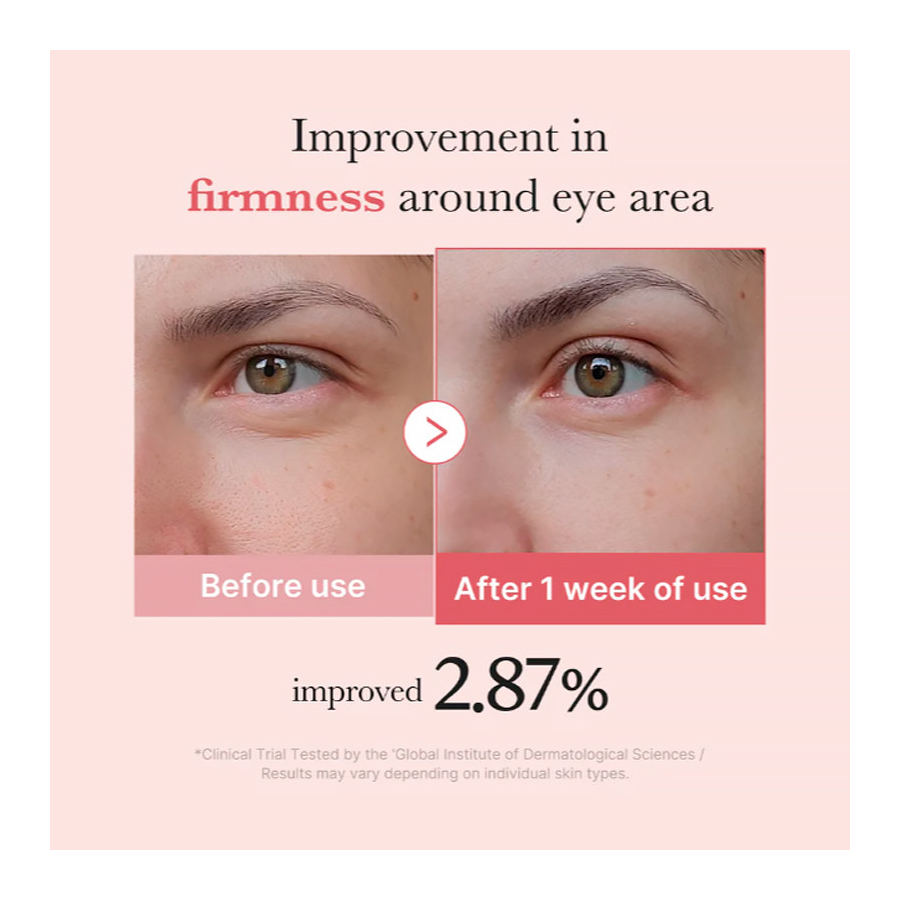 pdrn-pink-peptide-eye-cream-crema-regeneradora-contorno-de-ojo pdrn-pink-peptide-eye-cream-crema-regeneradora-contorno-de-ojo
