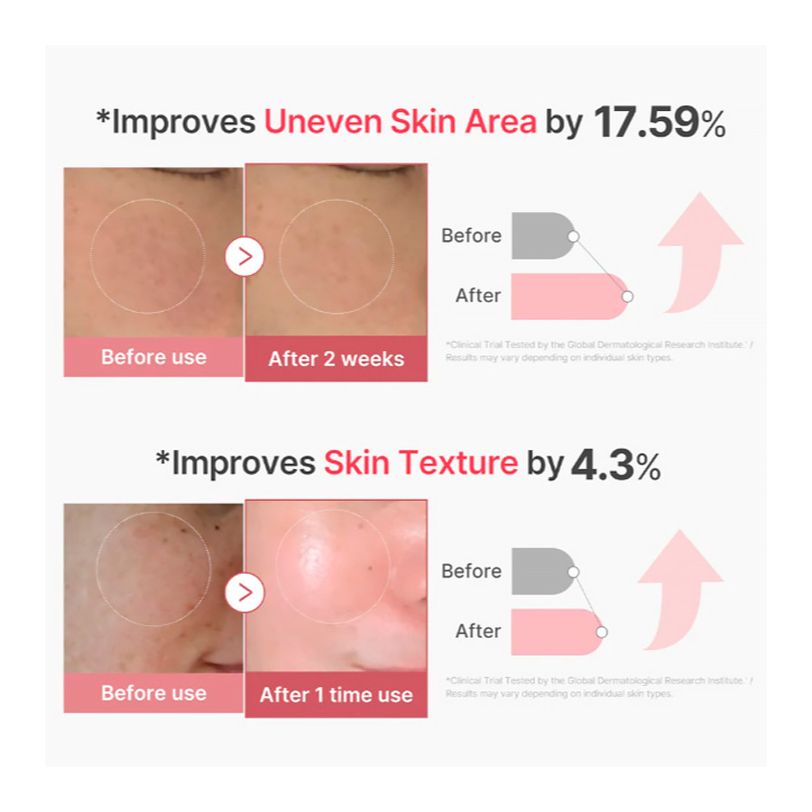 pdrn-pink-collagen-exosome-shot-serum-com-efeito-brilho-rosa pdrn-pink-collagen-exosome-shot-serum-com-efeito-brilho-rosa
