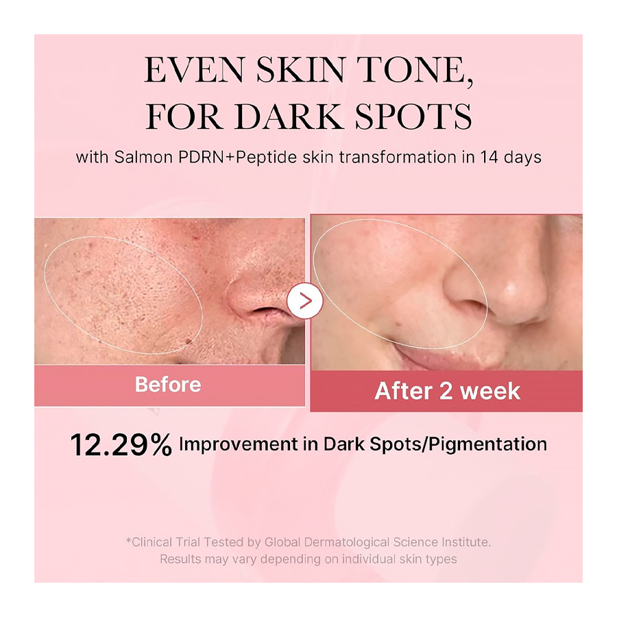 pdrn-pink-peptide-toner-cica-soothing-toner-with-pdrn-for-uneven-skin-tone-and-a-calming-effect