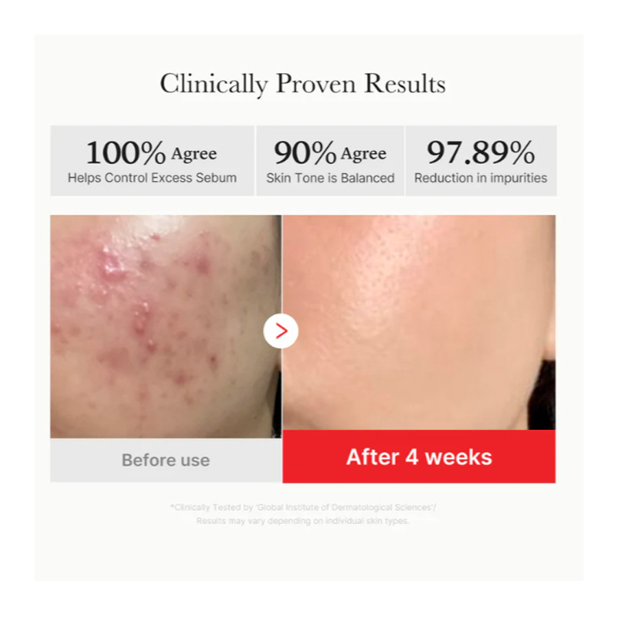 red-succinic-acid-panthenol-pads-exfoliating-facial-pads