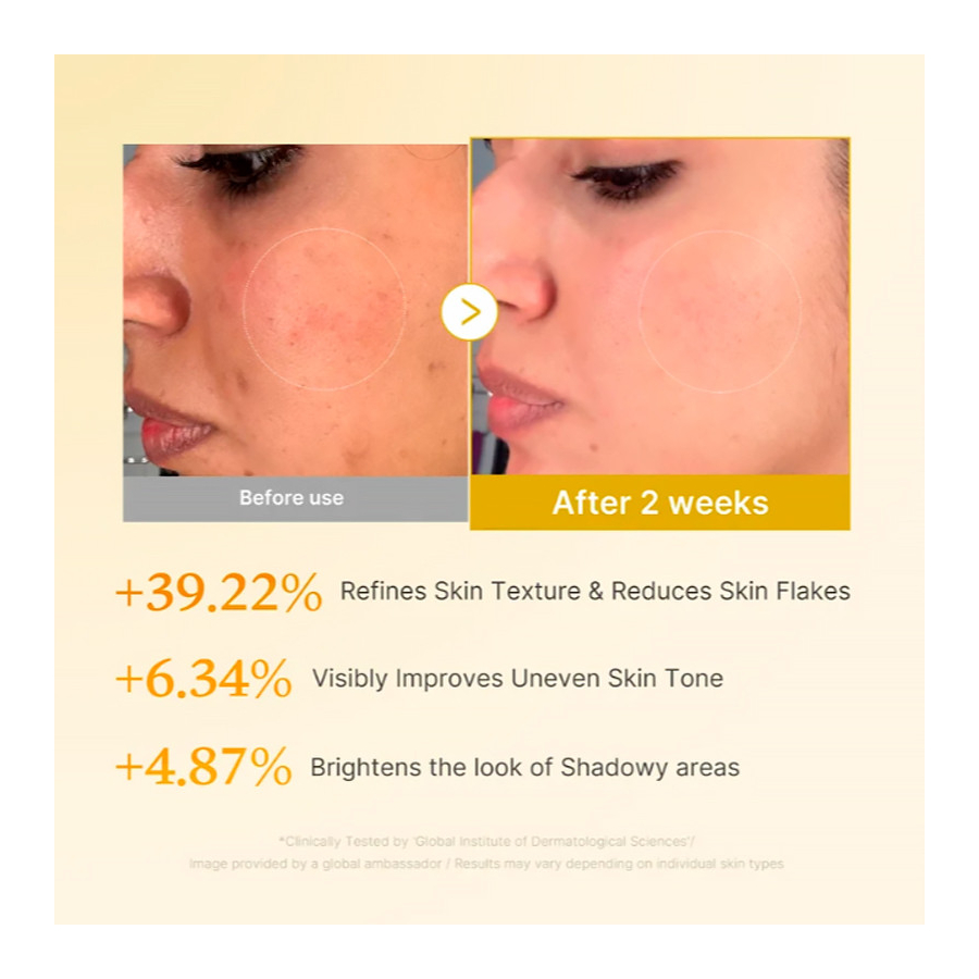 kojic-acid-turmeric-toner-soothing-turmeric-acid-toner-for-face-and-body kojic-acid-turmeric-toner-soothing-turmeric-acid-toner-for-face-and-body